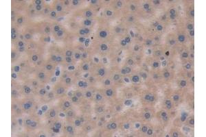 Immunohistochemistry (IHC) image for anti-Proteasome (Prosome, Macropain) Subunit, beta Type, 8 (Large Multifunctional Peptidase 7) (PSMB8) (AA 80-261) antibody (ABIN7440281)