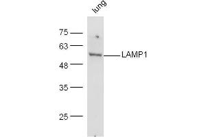 Western Blotting (WB) image for anti-Lysosomal-Associated Membrane Protein 1 (LAMP1) (AA 301-417) antibody (ABIN676088)