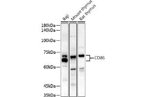 Western blot analysis of extracts of various cell lines, using CD86 antibody (ABIN7266226) at 1:500 dilution. (CD86 抗体)