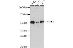 Western blot analysis of extracts of various cell lines, using Rad52 Rabbit mAb (ABIN7269828) at 1:1000 dilution. (RAD52 抗体)