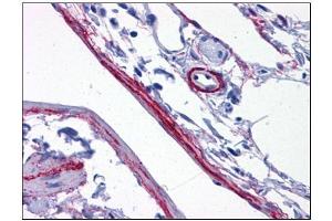 Human Perivascular Processes: Formalin-Fixed, Paraffin-Embedded (FFPE) (SYNPO 抗体  (C-Term))