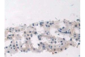 Immunohistochemistry (IHC) image for anti-Advanced Glycosylation End Product-Specific Receptor (AGER) (AA 1-237) antibody (ABIN7441463)