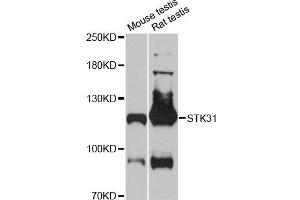 Western blot analysis of extracts of various cell lines, using STK31 antibody (ABIN6293705) at 1:3000 dilution. (STK31 抗体)