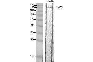 Western Blot (WB) analysis of HepG2 cells using NOS3 Polyclonal Antibody. (ENOS 抗体  (Thr180))
