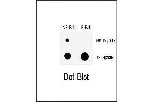 Dot blot analysis of anti-Phospho-CHK1- Antibody (ABIN389543 and ABIN2839588) on nitrocellulose membrane. (CHEK1 抗体  (pSer317))