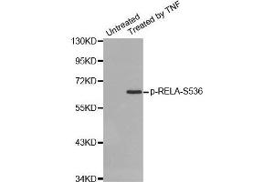 Western blot analysis of extracts from HepG2 cells using Phospho-RELA-S536 antibody. (NF-kB p65 抗体  (pSer536))