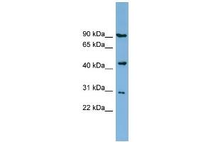 WB Suggested Anti-TUSC4 Antibody Titration:  0. (NPRL2 抗体  (Middle Region))