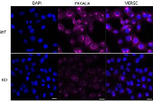 anti-C-AMP Protein Kinase (Catalytic Subunit) antibody
