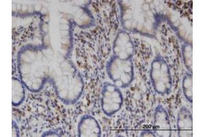 Image no. 2 for anti-Clathrin Interactor 1 (CLINT1) (AA 161-262) antibody (ABIN599495) (CLINT1 抗体  (AA 161-262))