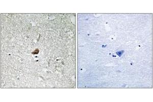 Immunohistochemistry analysis of paraffin-embedded human brain, using IRAK1 (Ab-376) Antibody. (IRAK1 抗体  (AA 342-391))