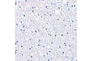 Immunohistochemistry of TIGAR in human brain tissue with this product at 2. (TIGAR 抗体  (Center))
