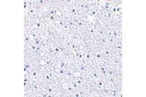 Immunohistochemistry of TIGAR in human brain tissue with this product at 2. (TIGAR 抗体  (Center))