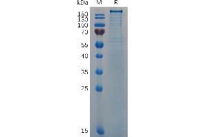 SDS-PAGE (SDS) image for Von Willebrand Factor (VWF) (AA 764-2813) protein (His tag) (ABIN7092836)
