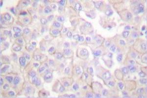 Image no. 1 for anti-Claudin 2 (CLDN2) antibody (ABIN265361) (Claudin 2 抗体)