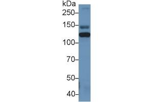 Western Blot; Sample: Rat Serum; Primary Ab: 1µg/ml Rabbit Anti-Human ITIH4 Antibody Second Ab: 0. (ITIH4 抗体  (AA 273-424))