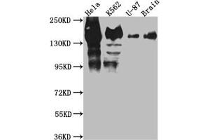 Western Blot Positive WB detected in: Hela whole cell lysate, K562 whole cell lysate, U-87 whole cell lysate, Mouse Brain whole cell lysate All lanes: SF3B1 antibody at 1:1000 Secondary Goat polyclonal to rabbit IgG at 1/50000 dilution Predicted band size: 146, 17 kDa Observed band size: 130 kDa (Recombinant SF3B1 抗体)