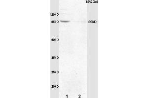 Formalin-fixed and paraffin embedded mouse embryo labeled with Anti-p95 NBS1/Cell cycle regulatory protein p95 Polyclonal Antibody, Unconjugated (ABIN762776) at 1:200 followed by conjugation to the secondary antibody and DAB staining. (Nibrin 抗体  (AA 641-754))