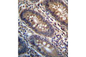 PG Antibody (Center) (ABIN657161 and ABIN2846295) immunohistochemistry analysis in formalin fixed and paraffin embedded human colon tissue followed by peroxidase conjugation of the secondary antibody and DAB staining. (PGAP3 抗体  (AA 141-169))
