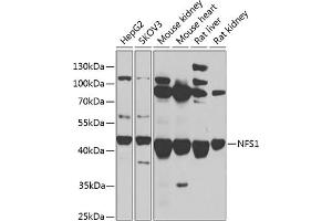 Western blot analysis of extracts of various cell lines, using NFS1 antibody (ABIN6130224, ABIN6144594, ABIN6144596 and ABIN6217361) at 1:1000 dilution. (NFS1 抗体  (AA 208-457))