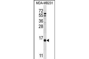 HINT3 Antibody (N-term) (ABIN657020 and ABIN2846199) western blot analysis in MDA-M cell line lysates (35 μg/lane). (HINT3 抗体  (N-Term))