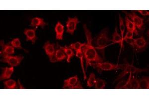ABIN6279645 staining HepG2 by IF/ICC. (CROT 抗体  (Internal Region))