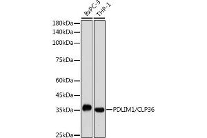 Western blot analysis of extracts of various cell lines, using PDLIM1/CLP36 antibody (ABIN7269195) at 1:1000 dilution. (PDLIM1 抗体)