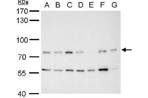WB Image MDM2 antibody detects MDM2 protein by western blot analysis.