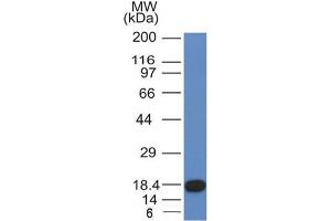 Western Blot Analysis of recombinant fragment of CD117 with CD117 Mouse Monoclonal Antibody (KIT/982). (KIT 抗体  (AA 100-300))