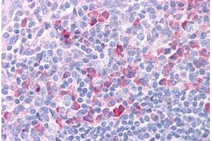 Human Tonsil: Formalin-Fixed, Paraffin-Embedded (FFPE) (DLL1 抗体  (N-Term))