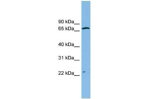 WB Suggested Anti-ZNF135 Antibody Titration: 0. (ZNF135 抗体  (N-Term))