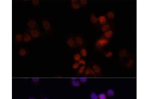 Immunofluorescence analysis of HCT116 cells using KDM7A Polyclonal Antibody at dilution of 1:150. (JHDM1D 抗体)