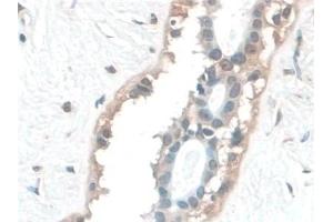 Immunohistochemistry (IHC) image for anti-Barrier To Autointegration Factor 1 (BANF1) (AA 2-89) antibody (ABIN7444295)
