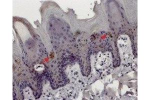 Immunohistochemistry (IHC) image for anti-Transient Receptor Potential Cation Channel, Subfamily M, Member 5 (TRPM5) (AA 32-45), (Intracellular) antibody (ABIN7043834)