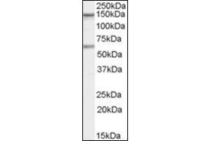 Antibody staining (1 µg/ml) of human Jurkat cells (RIPA buffer, 35 µg total protein per lane). (CARD11 抗体  (C-Term))