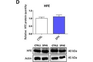 Iron export machinery-related hephaestin (HEPH) and the hemochromatosis gene (HFE) related to systemic iron loading are elevated at the mRNA level but not on the protein level in tumor-initiating cells (TICs)Expression of the HEPH gene at the mRNA level in breast non-malignant cell line MCF10A, in TICs derived from breast cancer cell lines MCF-7, BT-474, T-47D and ZR-75-30 as well as from prostate cancer cell lines DU-145 and LNCaP has been determined (A) together with protein levels in the MCF-7 cell line (CTRL) and MCF-7 derived spheres (SPH) (B). (HFE 抗体  (AA 262-348))