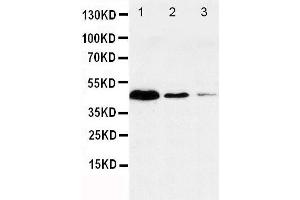 Anti-Caspase-1(P20) antibody, Western blotting Lane 1: JURKAT Cell Lysate Lane 2: RAJI Cell Lysate Lane 3: CEM Cell Lysate (Caspase 1 抗体  (N-Term))
