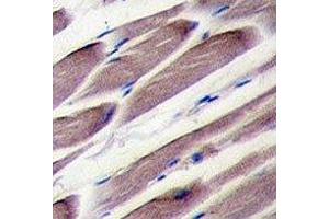 IHC analysis of FFPE human skeletal muscle tissue stained with LATS2 antibody (LATS2 抗体  (AA 228-258))