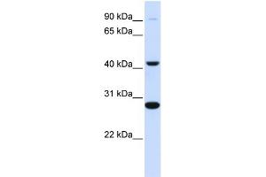WB Suggested Anti-CYB561 Antibody Titration:  0. (CYB561 抗体  (Middle Region))