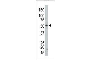 Image no. 2 for anti-Src-Related Kinase Lacking C-Terminal Regulatory Tyrosine and N-Terminal Myristylation Sites (SRMS) (C-Term) antibody (ABIN359994)