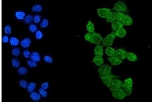 IF analysis of Ikaros using anti-Ikaros2 antibody (ABIN3043860).