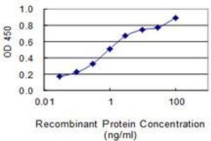 Detection limit for recombinant GST tagged FLJ35767 is 0. (FLJ35767 (AA 1-164) 抗体)