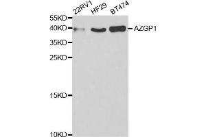 Western Blotting (WB) image for anti-alpha-2-Glycoprotein 1, Zinc-Binding (AZGP1) antibody (ABIN1876553) (AZGP1 抗体)