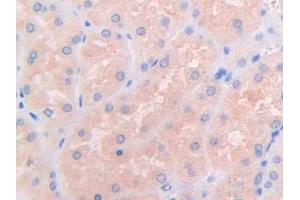 DAB staining on IHC-P; Samples: Human Kidney Tissue (IL3RA 抗体  (AA 19-158))