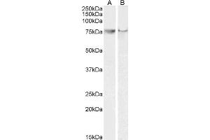 ABIN184672 (0. (PTGS2 抗体  (C-Term))