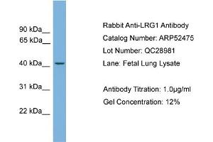 WB Suggested Anti-LRG1  Antibody Titration: 0.