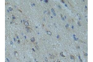 Immunohistochemistry (IHC) image for anti-SMAD Family Member 9 (SMAD9) (AA 226-459) antibody (ABIN7442282)