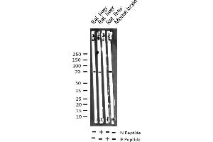 Western blot analysis of Phospho-p70 S6 Kinase (Thr421) expression in various lysates (RPS6KB1 抗体  (pThr421))