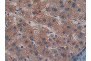Detection of PLXNB1 in Human Liver Tissue using Polyclonal Antibody to Plexin B1 (PLXNB1)