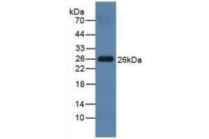 Detection of PRSS2 in Mouse Testis lysate using Polyclonal Antibody to Protease, Serine 2 (PRSS2) (PRSS2 抗体  (AA 29-240))