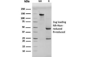 SDS-PAGE Analysis Purified Pan-Cytokeratin Mouse Monoclonal Antibody (PCK/3150). (KRT 抗体)